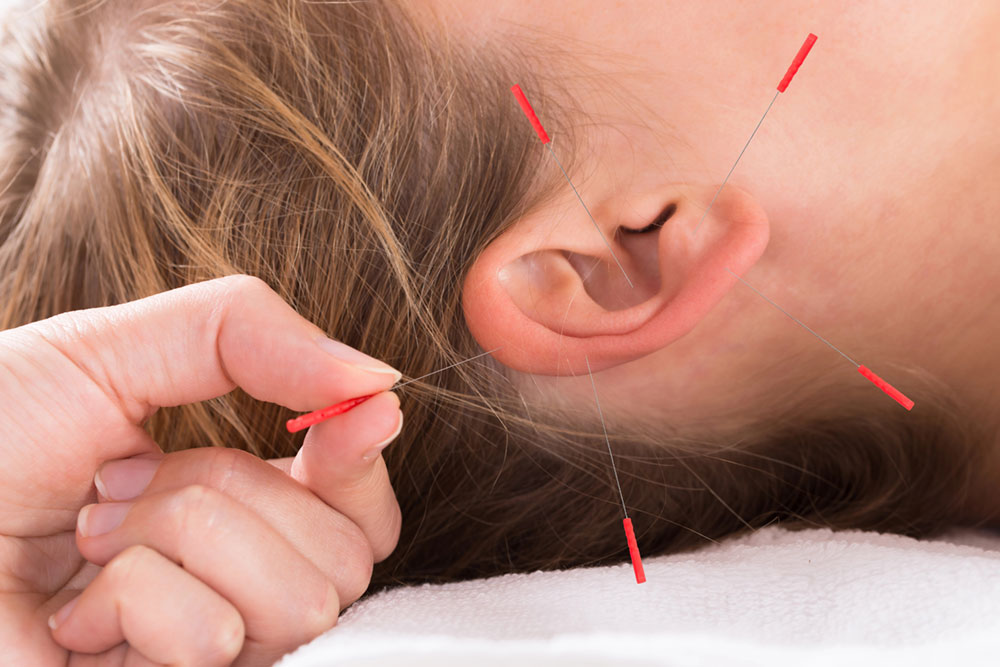 Auricular Acupuncture Balance Through the Ear natsthetics pontypool Auricular Acupuncture Balance Through the Ear natsthetics pontypool